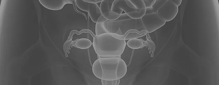Investigação ex-vivo sobre o potencial da luz laser diodo de 1470 nm para enucleação de leiomioma uterino